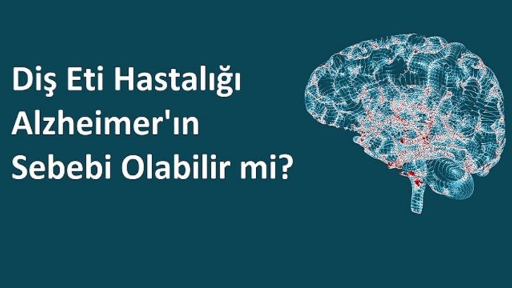 Diş Eti Hastalığı Alzheimer’in Sebebi Olabilir mi?